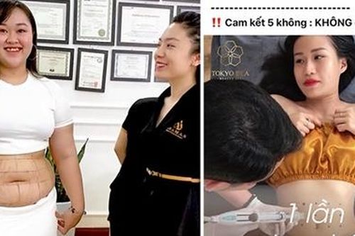 Những chiêu bịp giảm béo thần tốc