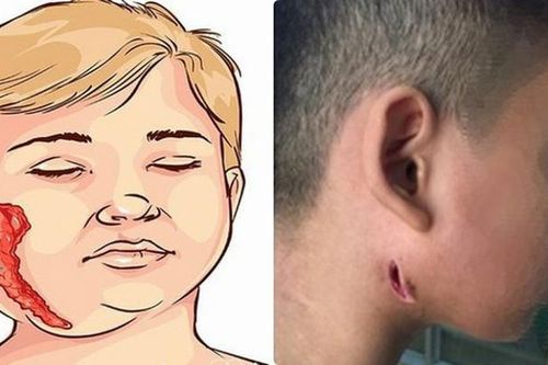 Những căn bệnh chết người 'ám ảnh' nhất năm 2019