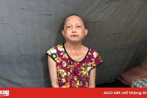 Thương một phụ nữ mắc bệnh xơ cứng bì