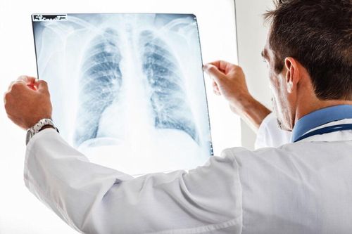 Hút thuốc lá điện tử có thể dẫn tới bệnh phổi hiếm gặp