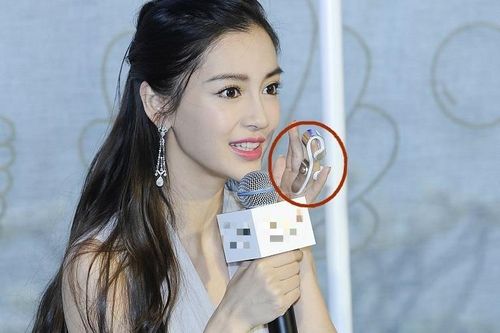 Angelababy phải đeo nẹp ngón tay sau tai nạn quay show