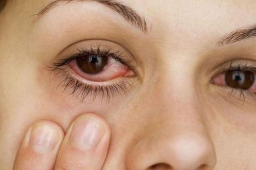 Gỉ mắt thế nào là bất thường?