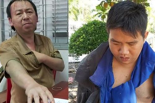 Hai cẩu tặc táo tợn ép ngã xe công an xã làm 1 người bị thương
