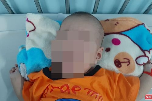 Lần đầu mổ nội soi thắt ống ngực, cứu sống cháu bé 3 tháng tuổi bị nguy kịch