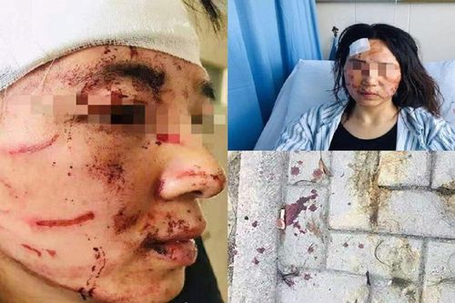 Nghi ngoại tình, gã chồng cùng bố hợp lực đánh đập vợ dã man ngay trên phố