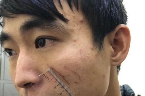 Dùng chăn giết người yêu trong lúc phê ma túy