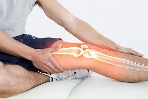 Cách chống thoái hóa khớp đơn giản mà hiệu quả không thể ngờ