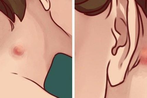 3 thay đổi lạ trên cổ ngầm cảnh báo tế bào ung thư có thể đang chực chờ 'trỗi dậy'