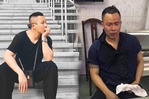Vũ Khắc Tiệp nói gì về bức ảnh mặt mũi đầy máu, ngồi trong đồn công an?