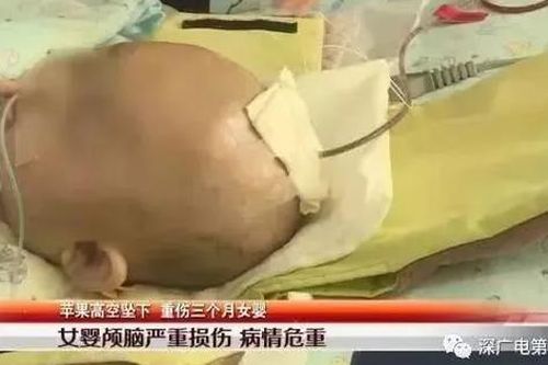 Đứa bé 3 tháng được bà ẵm đi dạo thì bị trái táo rơi trúng đầu rơi vào nguy kịch, danh tính thủ phạm khiến nhiều người bất ngờ