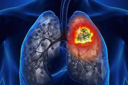 Lời khuyên từ các bác sĩ đã bị ung thư: Tư tưởng không tốt là 'thủ phạm' gây ung thư số 1