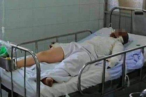 Hà Nam: Đốt pháo tự chế một người bị thương nặng