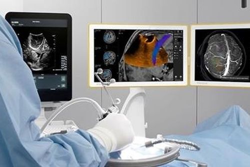 Lần đầu tiên siêu âm định vị trong phẫu thuật u não