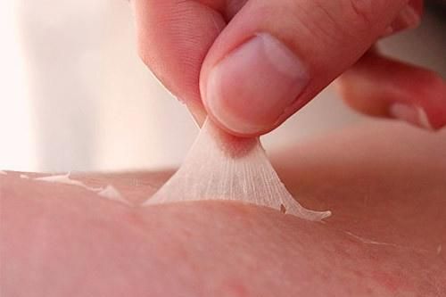 Làm gì khi da bị cháy nắng?