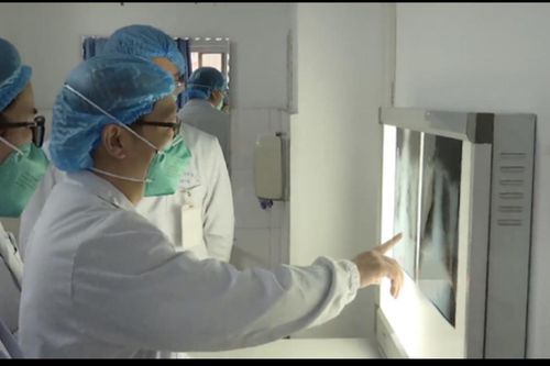 Trung Quốc khẳng định coronavirus lây từ người sang người, 6 người chết