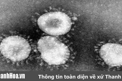 Thanh Hóa: Triển khai chỉ đạo của Thủ tướng Chính phủ về phòng chống dịch bệnh viêm phổi cấp
