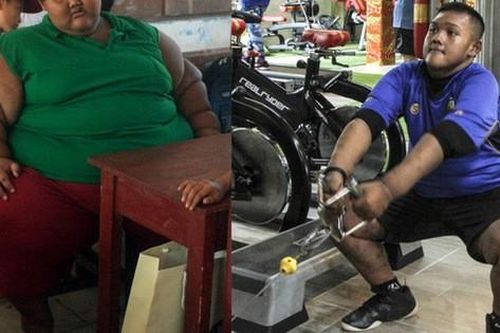 'Cậu bé nặng nhất thế giới' với gần 200kg sau 4 năm phẫu thuật thu nhỏ dạ dày giờ 'lột xác' không ai nhận ra