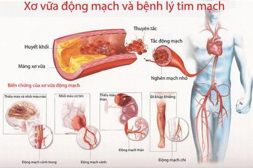 Một số chứng bệnh tim nguy hiểm thường gặp