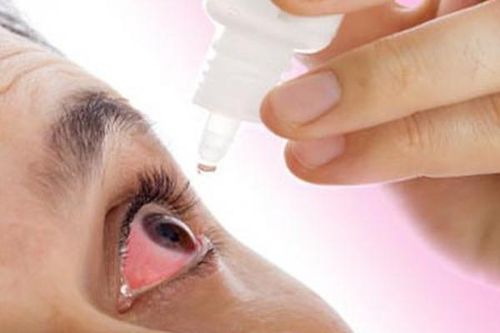 Lựa chọn thuốc trị viêm kết mạc dị ứng