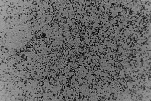Âm tính với virus corona vẫn có nguy cơ lây nhiễm trong tương lai