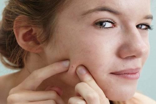 Sai lầm khiến làn da bị tổn thương nghiêm trọng