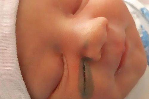 Nghe lời bác sĩ sinh mổ, sản phụ phẫn nộ khi nhìn thấy con mình