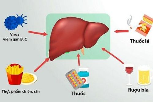 Xử trí men gan tăng cao
