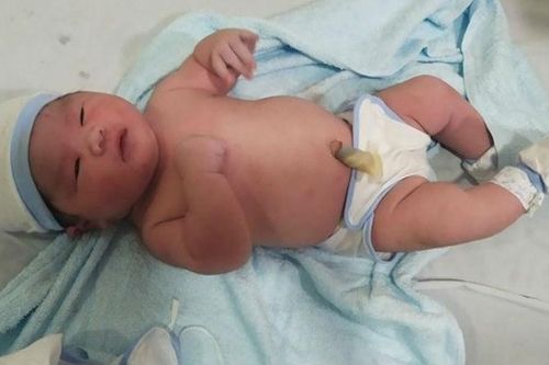 Bé trai nặng 6,5 kg chào đời ở Khánh Hòa