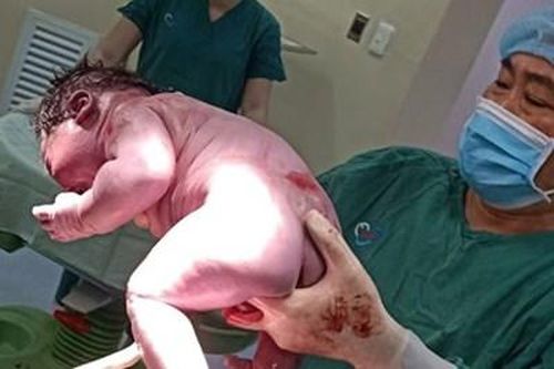 Bé trai 'khổng lồ' chào đời khỏe mạnh bằng phương pháp sinh mổ