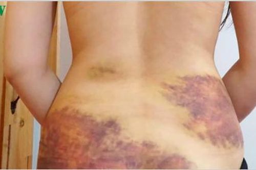 Chồng đánh vợ dã man ở Tây Ninh do ghen tuông