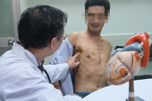 Thay van tim lần 2 bằng đường mổ nhỏ