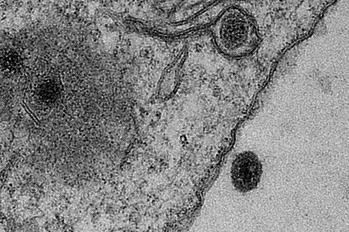 Phát hiện virus khác thường chưa từng được biết đến