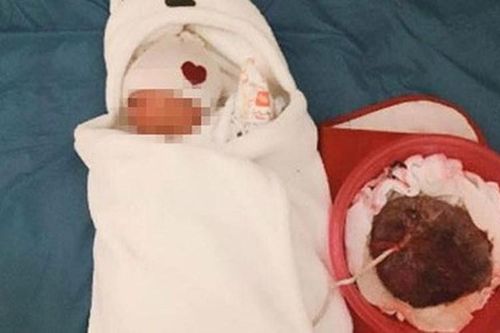 'Sinh thuận tự nhiên' sau 6 giờ em bé chưa được cắt dây rốn, nguy hiểm tính mạng