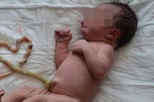 Sản phụ sinh 'thuận tự nhiên' không cho bác sĩ điều trị