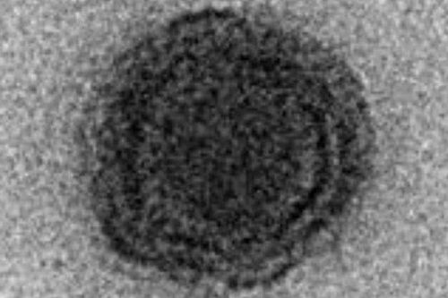 Brazil: Phát hiện virus lạ với 90% gien chưa từng được biết tới