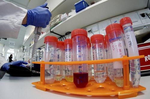 Huyết tương người nhiễm Covid-19 phục hồi có thể trị được virus