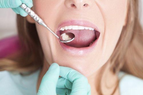 Người phụ nữ mọc lông trong miệng