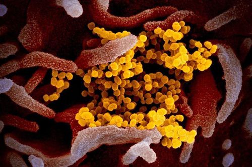 Hình ảnh virus Covid-19 len lỏi trong tế bào người
