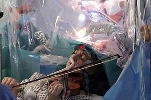 Một bệnh nhân chơi vĩ cầm trong khi phẫu thuật u não