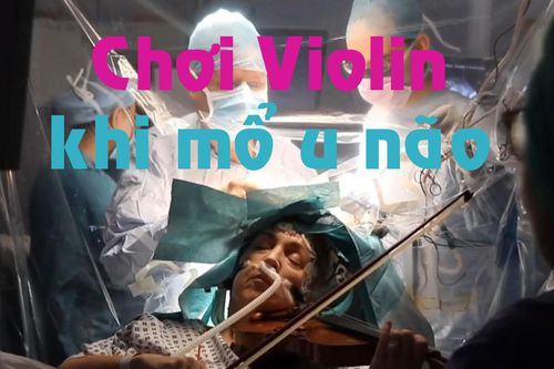 Kinh ngạc nữ giáo sư chơi violin khi được mổ u não