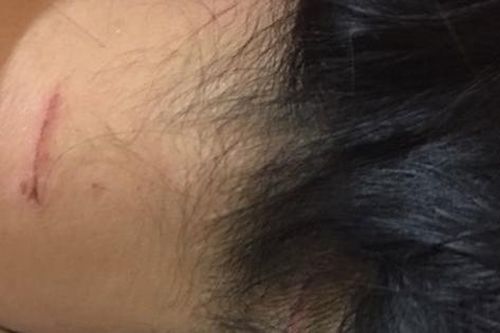 Cựu công an đánh vợ cũ lĩnh án 15 tháng tù