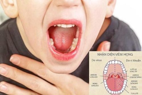 Cách bảo vệ họng cho trẻ, tránh nhiễm bệnh
