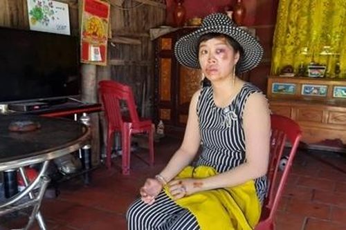 Truy lùng đối tượng liên quan 2 vụ cướp giật táo tợn tài sản của phụ nữ