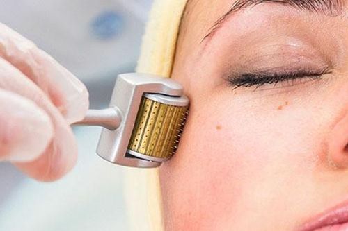 Lăn kim tại spa, một phụ nữ bị phù nề da mặt, mưng mủ