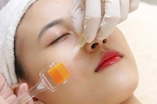 Làm đẹp 'lăn kim' xong phải nhập viện gấp