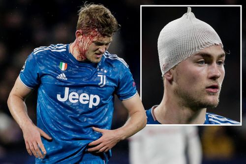 Trung vệ đắt giá đổ máu vẫn không cứu nổi Juve