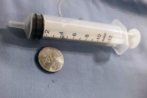 Gắp viên pin đang oxy hóa ra khỏi dạ dày bé gái 16 tháng tuổi