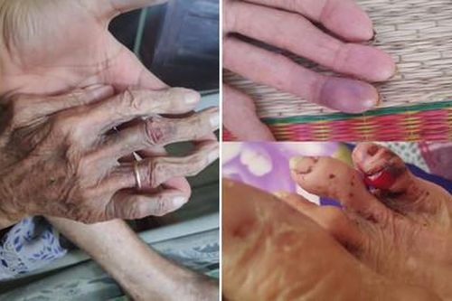 Tạm giữ con trai và con dâu ngược đãi, bạo hành mẹ 88 tuổi