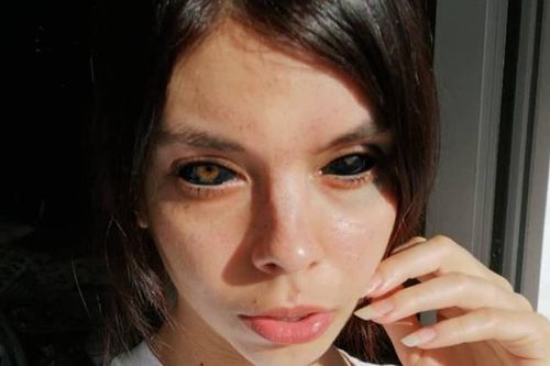 Tuổi trẻ bồng bột, cô gái trẻ quyết định đi xăm mắt và nhận lại cái kết đắng