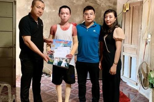 Trao 21,4 triệu đồng cho cháu bé ở Hà Tĩnh bị bỏng 71% mà không có tiền chữa trị